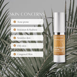 ACNE CONTROL SERUM