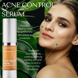 Acne Control Serum