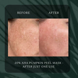 20% AHA Pumpkin Peel Mask 