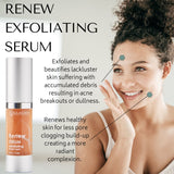 Renew Exfoliating Serum 